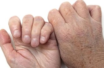 Как устранить сухость кожи рук